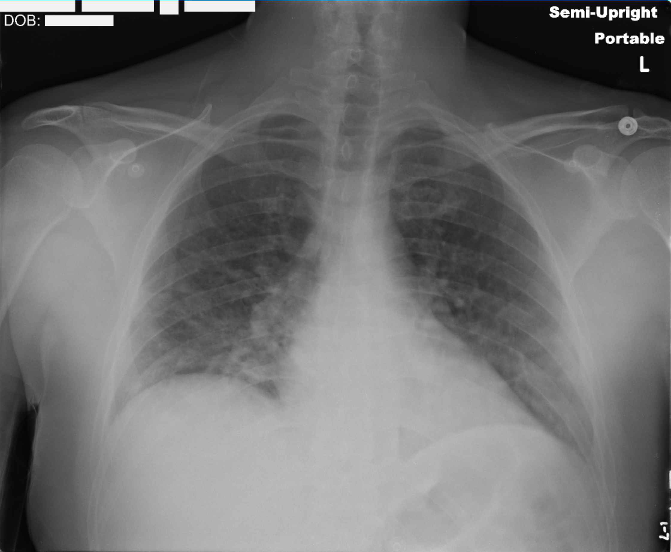 Features Image